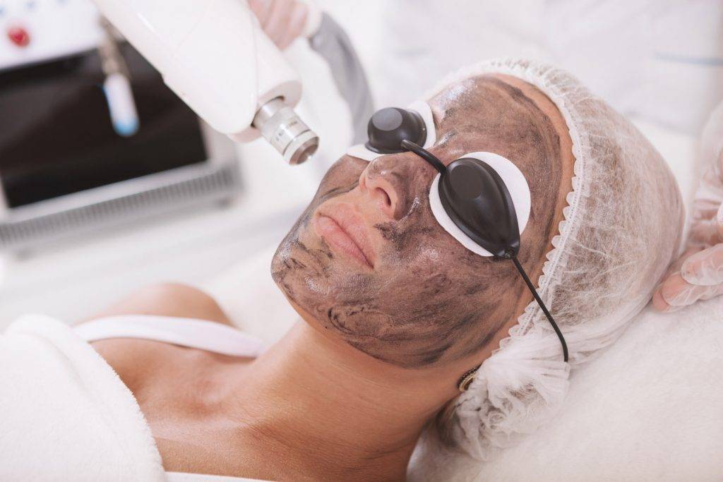 woman recieving Carbon facial with picolazer, Rasaderm skincare