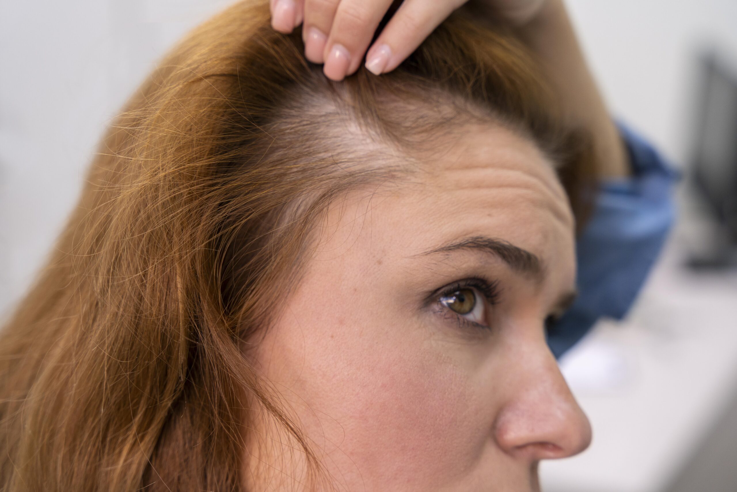 Types of Hair Treatment
