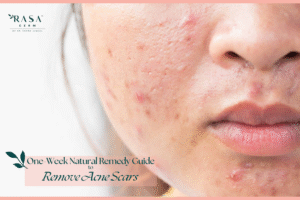 One Week Natural Remedy Guide To Reduce Acne Scars