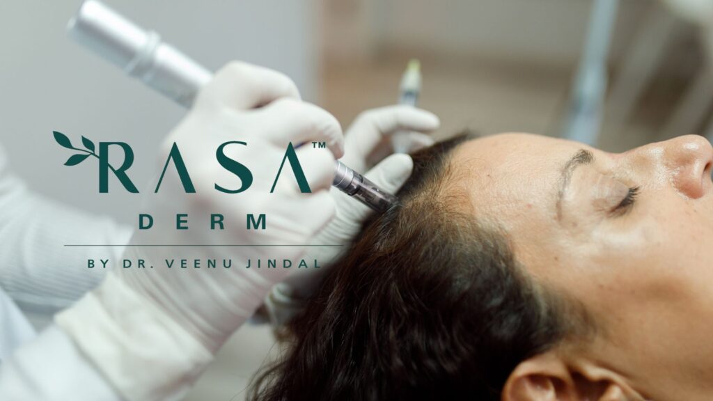 Exosome Treatment