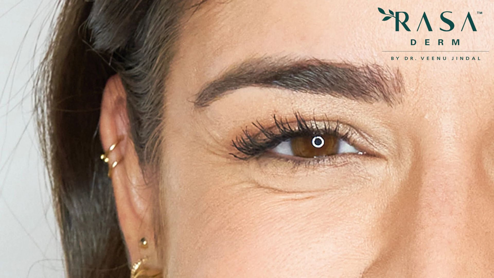 under eye wrinkle home remedies
