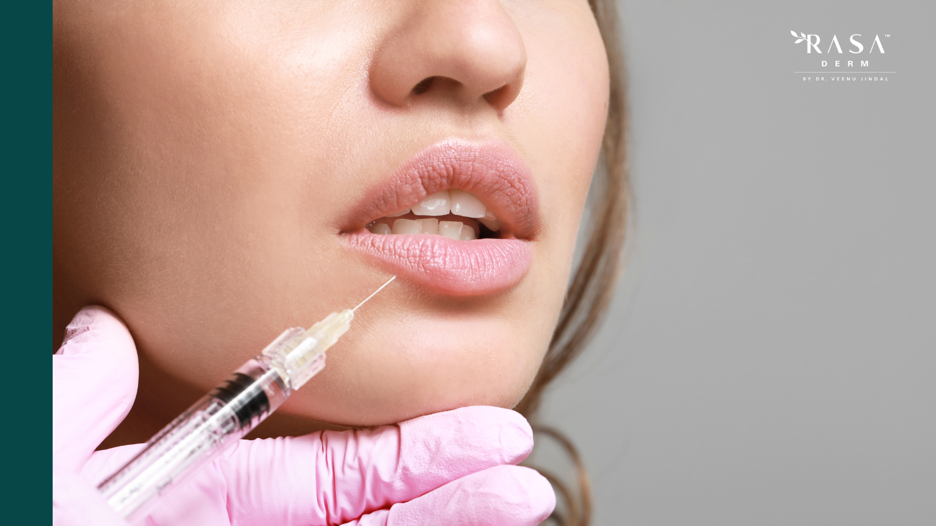 Lip Fillers