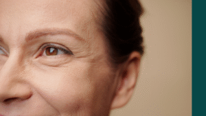 Under-Eye Wrinkles: Causes, Treatment Options and How to Reduce Their Appearance