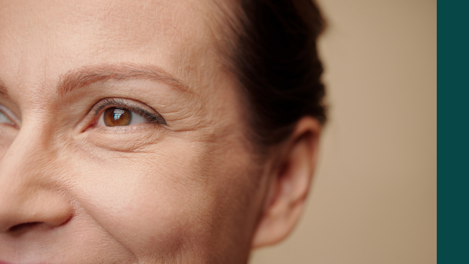 Under-Eye Wrinkles