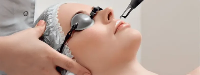 Picosure Laser